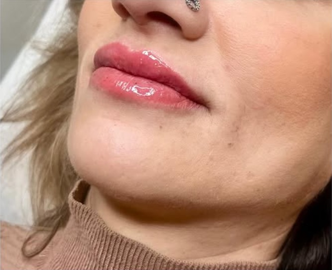 Specialiserade på Botox i Vasastan